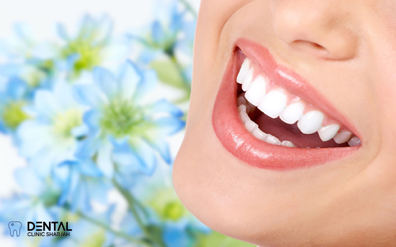 Professional Bleaching at Dental Clinic Sharjah