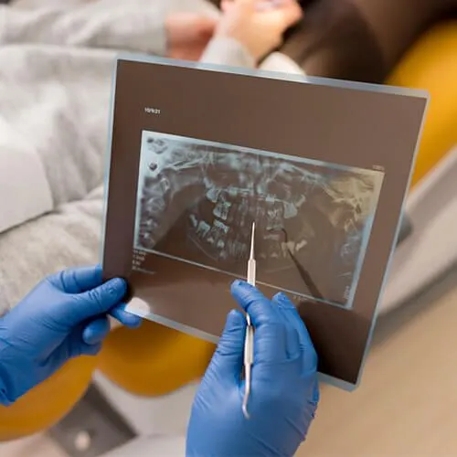 3d-guided-dental-implants 3d-guided-dental-implants