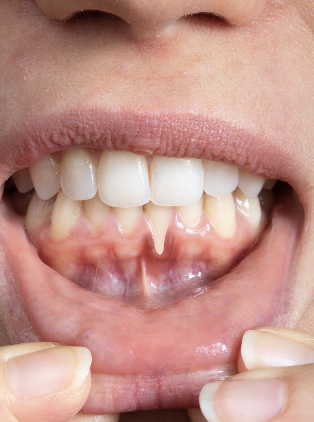 gums care