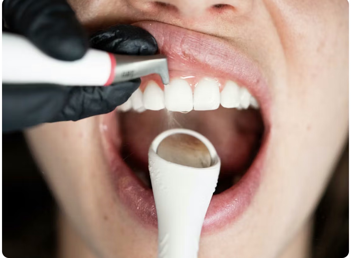 air flow dental cleaning air flow dental cleaning